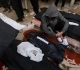 For the 193rd day... martyrs and wounded in the ongoing Israeli war on the Gaza Strip