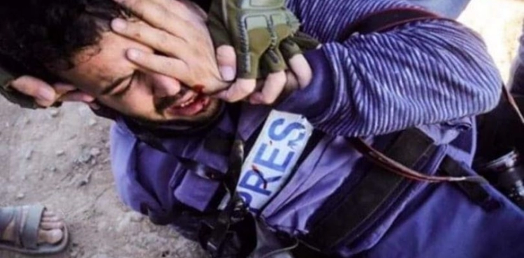 B&acute;Tselem: 19 demonstrators in Gaza who lost their eyes due to the occupation bullets