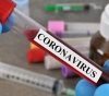 Corona sufferers worldwide exceed 12 million