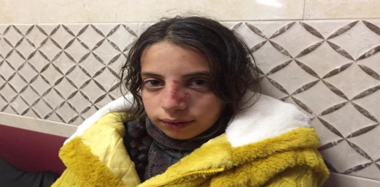 A child was wounded during a settler attack on Madama village, south of Nablus