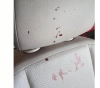 Settlers attack the car of a lawyer from Tamra and severely injure his wife