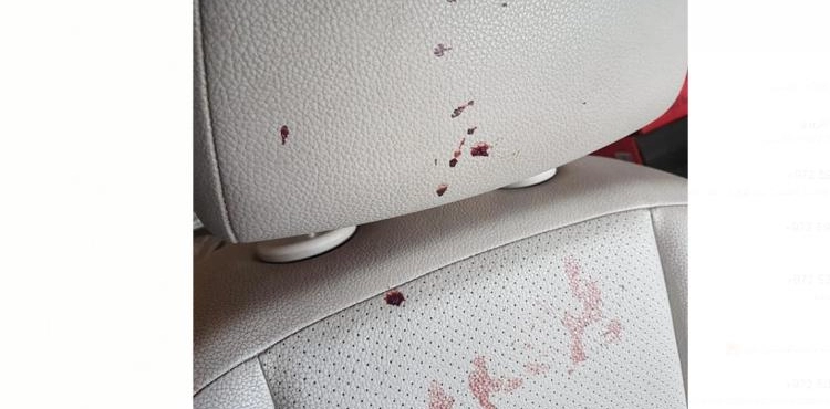 Settlers attack the car of a lawyer from Tamra and severely injure his wife