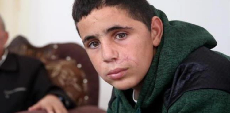 The occupation forces the child Mohammed al-Tamimi for the third time since his injury