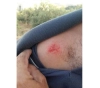 &quot;Biting&quot; one of the weapons of the occupation soldiers during the incursions