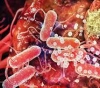 Researchers expect a sweeping wave of cancerous diseases worldwide