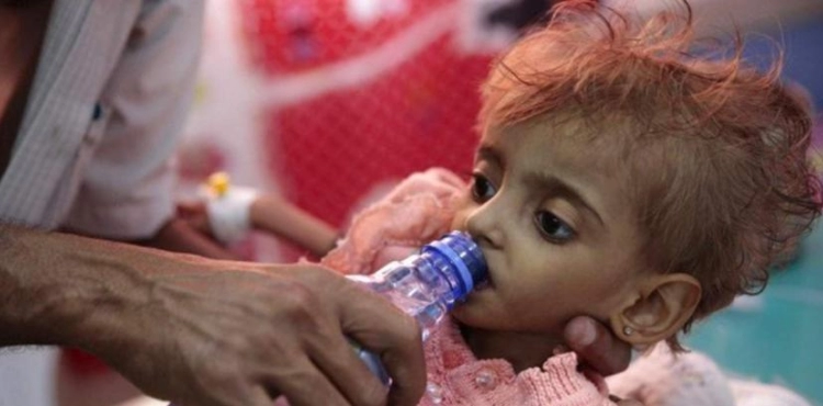 257 Yemenis die of diphtheria epidemic in nearly two years