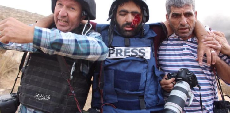Journalist Mo&acute;ath Amarneh was shot in the eye