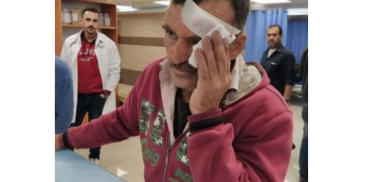A farmer injured by settlers during an olive harvest