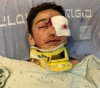 A child was wounded by the Israeli occupation forces