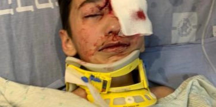 A child was wounded by the Israeli occupation forces