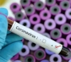 Official: 40 Americans confirmed to be infected with Corona virus on a cruise ship in Japan