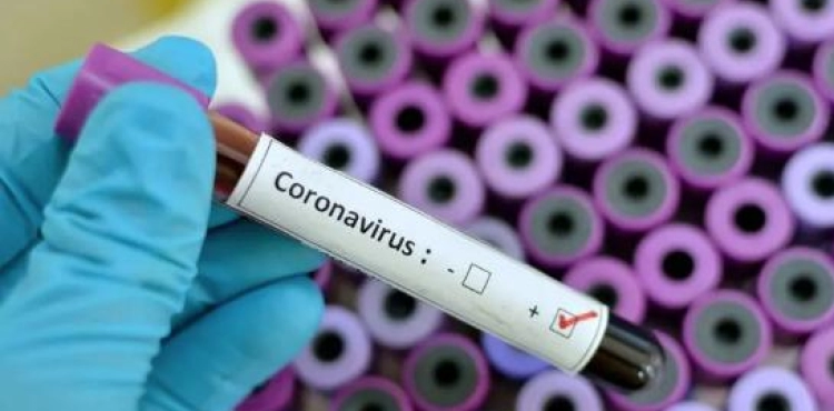 Official: 40 Americans confirmed to be infected with Corona virus on a cruise ship in Japan