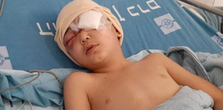 Easa childÂ´s eye removed after several attempts to treat it