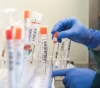 The number of people recovering from the Corona virus in Kuwait increased to 93 cases