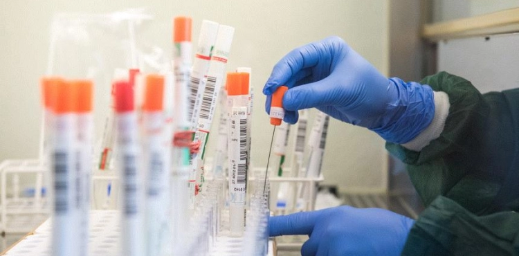 The number of people recovering from the Corona virus in Kuwait increased to 93 cases