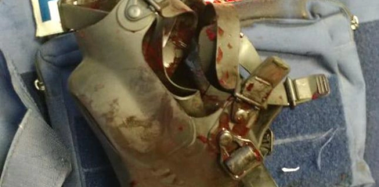 Four citizens, including two journalists, were injured in the Nablus clashes