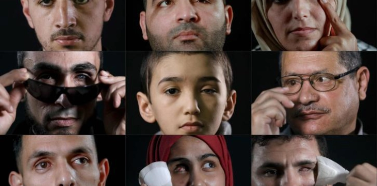 Palestinians whose eyes are turned off by the occupation ... How have their lives been upended?