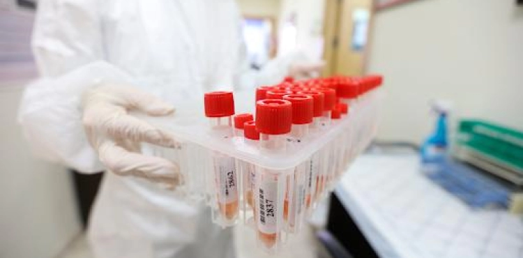 Health: 67 new cases of corona raise todayâ€™s injuries to 322