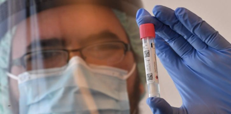 European Union book 300 million doses of &quot;Corona vaccine&quot;