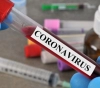 8 deaths and 692 new cases of &quot;Corona&quot; virus during the past 24 hours
