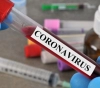 7 deaths and 420 new cases of &quot;Corona&quot; virus during the last 24 hours