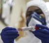 266 deaths and 6,425 injuries among Palestinian communities since the start of the Corona pandemic