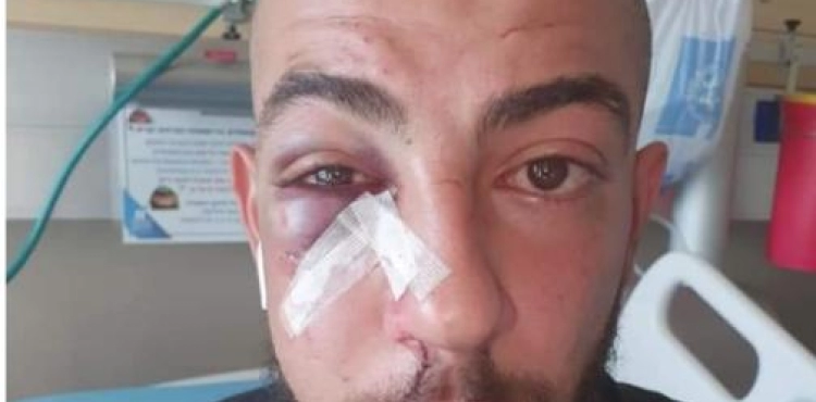 A young man was wounded and fractured as a result of the occupationâ€™s assault on him in occupied Jerusalem