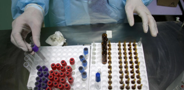 21 deaths and 2,170 new cases of corona