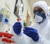 Health: 10 deaths, 670 new cases of corona, and 739 recoveries during the past 24 hours
