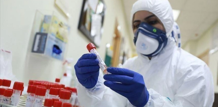 Health: 10 deaths, 670 new cases of corona, and 739 recoveries during the past 24 hours