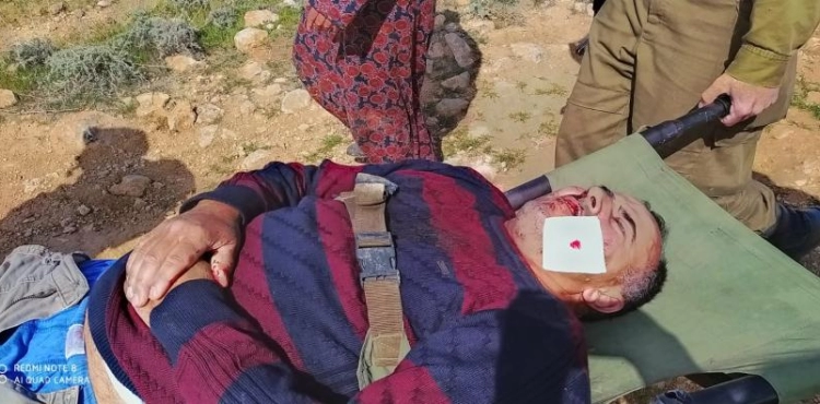 Settlers attack a Palestinian family, east of Yatta