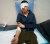 Child Ezz El-Din Al-Batsh loses his eye by the bullets of the occupation in Hebron
