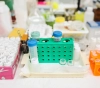 Israeli Health records 21 cases of the Indian mutation