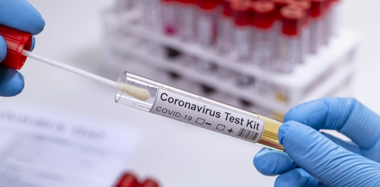 Two deaths, 182 new cases of corona virus, and 51 recoveries during the past 24 hours