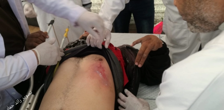 Two martyrs. and 62 injuries. In the occupation attack on the return marches east of Gaza