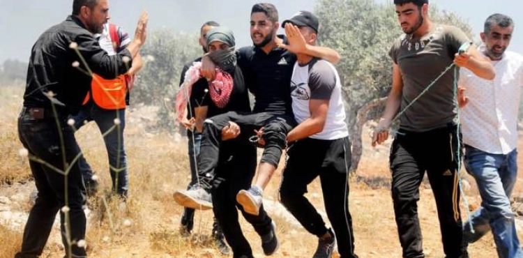 Two young men were injured by the occupation bullets, and dozens suffocated during clashes in Beita