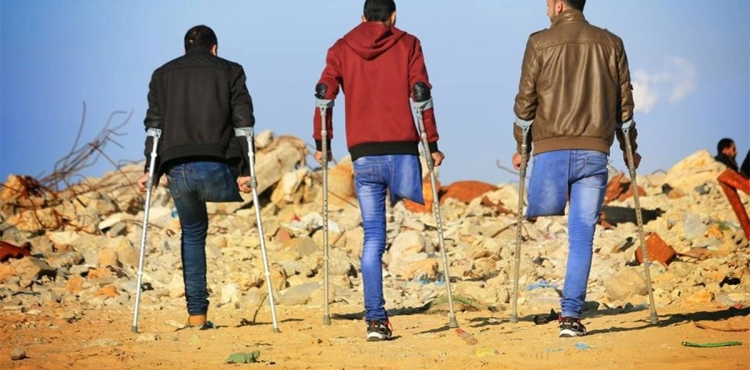 1700 people are threatened with limb amputation in Gaza