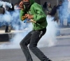 Suffocation injuries during the occupation suppression of the Kafr Qaddoum march